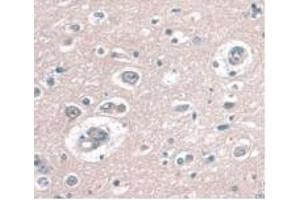 IHC-P analysis of Human Brain Tissue, with DAB staining. (CD34 Antikörper  (AA 32-290))