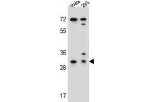 Western Blotting (WB) image for anti-Ephrin B2 (EFNB2) antibody (ABIN2996297) (Ephrin B2 Antikörper)