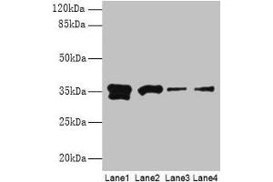 Western blot All lanes: APEX1 antibody at 2 μg/mL Lane 1: Hela whole cell lysate Lane 2: Mouse brain tissue Lane 3: MCF-7 whole cell lysate Lane 4: A431 whole cell lysate Secondary Goat polyclonal to rabbit IgG at 1/15000 dilution Predicted band size: 36 kDa Observed band size: 36 kDa (APEX1 Antikörper  (AA 32-318))