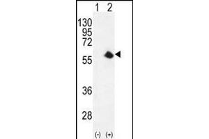 Western blot analysis of CDK8 (arrow) using rabbit polyclonal CDK8 Antibody (Center) (ABIN655911 and ABIN2845310). (CDK8 Antikörper  (AA 249-277))