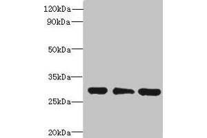 Western blot All lanes: HDHD3 antibody at 1 μg/mL Lane 1: Mouse small intestine tissue Lane 2: HT29 whole cell lysate Lane 3: COLO205 whole cell lysate Secondary Goat polyclonal to rabbit IgG at 1/10000 dilution Predicted band size: 28 kDa Observed band size: 28 kDa (HDHD3 Antikörper  (AA 1-251))