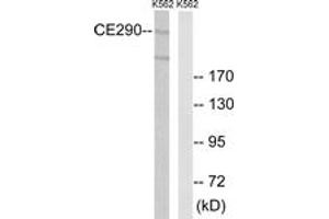 Western blot analysis of extracts from K562 cells, using CEP290 Antibody. (CEP290 Antikörper  (AA 771-820))