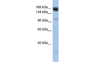 UBE4B antibody used at 1 ug/ml to detect target protein.