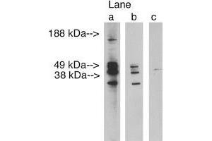 Image no. 1 for anti-Ceramide Synthase 3 (CERS3) antibody (ABIN4620355) (LASS3 Antikörper)