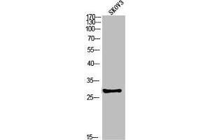 Western blot analysis of SKOV3 using p-PP2A-Cα (Y307) antibody. (PPP2CA Antikörper  (pTyr307))