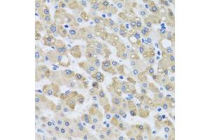 Immunohistochemistry of paraffin-embedded human liver injury using SNAP29 antibody.