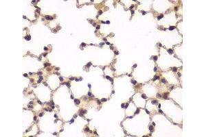 Immunohistochemistry of paraffin-embedded Mouse lung using PIP4K2A Polyclonal Antibody at dilution of 1:100 (40x lens). (PIP4K2A Antikörper)