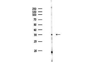 anti-Carbohydrate (N-Acetylgalactosamine 4-0) Sulfotransferase 8 (CHST8) (C-Term) antibody