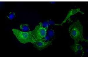 Anti-KIAA1609 mouse monoclonal antibody (ABIN2453202) immunofluorescent staining of COS7 cells transiently transfected by pCMV6-ENTRY KIAA1609 (RC209287). (KIAA1609 Antikörper)