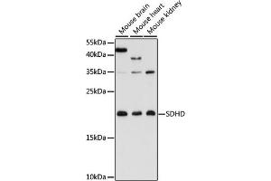 Western blot analysis of extracts of various cell lines, using SDHD antibody (ABIN7270622) at 1:3000 dilution. (SDHD Antikörper  (AA 50-150))