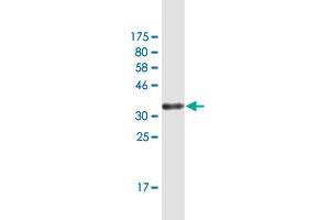Western Blot detection against Immunogen (34. (GLIPR1 Antikörper  (AA 23-99))