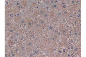 DAB staining on IHC-P; Samples: Human Liver Tissue (C5A Antikörper  (AA 678-751))