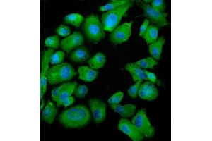 IF analysis of SND1 using anti-SND1 antibody (ABIN7600527). (SND1 Antikörper  (AA 20-204))