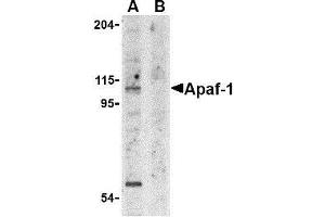 Western blot analysis of Apaf1 in K562 cell lysate with AP30055PU-N Apaf1 antibody at 1 μg/ml in the (A) absence and (B) presence of blocking peptide.