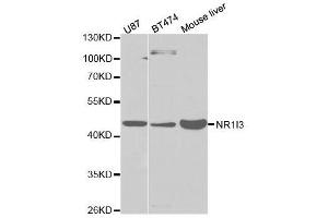 Western blot analysis of extracts of various cell lines, using NR1I3 antibody. (NR1I3 Antikörper  (AA 103-352))