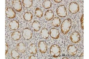 Image no. 1 for anti-Ceramide Synthase 6 (CERS6) (AA 62-132) antibody (ABIN466277) (CERS6 Antikörper  (AA 62-132))