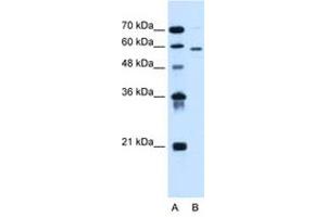 Image no. 2 for anti-Asparagine-Linked Glycosylation 11, alpha-1,2-Mannosyltransferase Homolog (Yeast) (ALG11) (AA 392-441) antibody (ABIN6736673) (ALG11 Antikörper  (AA 392-441))