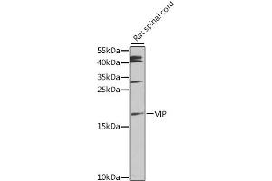 Western blot analysis of extracts of rat spinal cord, using VIP antibody (ABIN6130781, ABIN6150111, ABIN6150112 and ABIN6216193) at 1:1000 dilution. (Vip Antikörper  (AA 31-170))