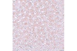 Immunohistochemistry (IHC) image for anti-alpha-Fetoprotein (AFP) (N-Term) antibody (ABIN1031219)