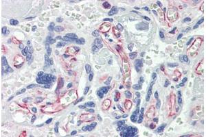 Immunohistochemistry (Paraffin-embedded Sections) (IHC (p)) image for anti-Caspase 7, Apoptosis-Related Cysteine Peptidase (CASP7) antibody (ABIN462356)