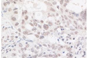 Immunohistochemistry (IHC) image for anti-AT Rich Interactive Domain 2 (ARID, RFX-Like) (ARID2) (AA 1785-1835) antibody (ABIN7453593) (ARID2 Antikörper  (AA 1785-1835))