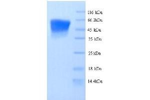 SDS-PAGE (SDS) image for UDP Glucuronosyltransferase 1 Family, Polypeptide A1 (UGT1A1) (AA 26-533) protein (His tag) (ABIN5713928) (UGT1A1 Protein (AA 26-533) (His tag))