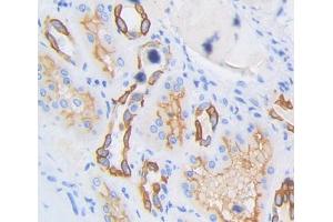 Used in DAB staining on fromalin fixed paraffin- embedded kidney tissue (SPTLC3 Antikörper  (AA 238-552))