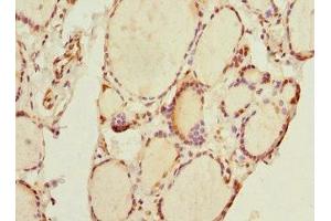 Immunohistochemistry of paraffin-embedded human thyroid tissue using ABIN7172156 at dilution of 1:100 (THRSP Antikörper  (AA 1-146))