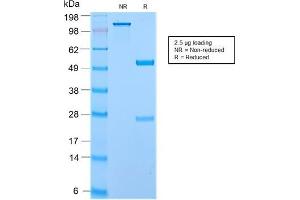 SDS-PAGE Analysis of Purified Secretory Component Rabbit Recombinant Monoclonal (ECM1/2889R). (Rekombinanter ECM1 Antikörper)