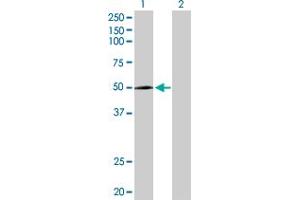 Western Blot analysis of CYP2R1 expression in transfected 293T cell line by CYP2R1 MaxPab polyclonal antibody. (CYP2R1 Antikörper  (AA 1-501))