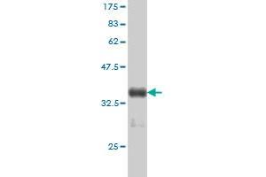 Western Blotting (WB) image for anti-Thymidylate Synthetase (TYMS) (AA 111-210) antibody (ABIN563306)