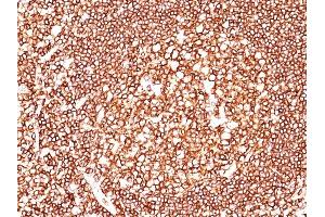Formalin-fixed, paraffin-embedded human Tonsil stained with CD45 Mouse Monoclonal Antibody (2B11+PD7/26). (CD45 Antikörper  (FITC))