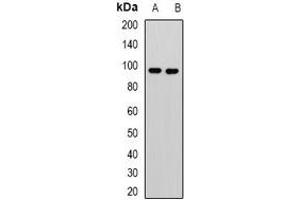 Western blot analysis of KANSL3 expression in Jurkat (A), U251 (B) whole cell lysates. (KANSL3 Antikörper)