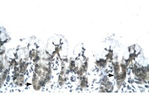 Human Stomach (ADIPOQ Antikörper  (N-Term))
