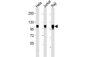All lanes : Anti-ITGA7 Antibody (C-term) at 1:2000 dilution Lane 1: Hela whole cell lysates Lane 2: Jurkat whole cell lysates Lane 3: Raji whole cell lysates Lysates/proteins at 20 μg per lane. (ITGA7 Antikörper  (C-Term))