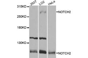 Western blot analysis of extracts of various cell lines, using NOTCH2 antibody. (NOTCH2 Antikörper)