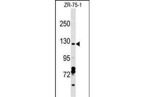 CCD Antibody (C-term) (ABIN1537645 and ABIN2849114) western blot analysis in ZR-75-1 cell line lysates (35 μg/lane). (Syndetin/VPS50 Antikörper  (C-Term))