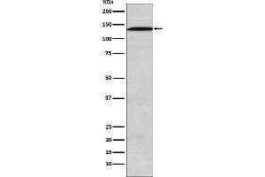 Western blot analysis of USP28 expression in SW480 cell lysate.