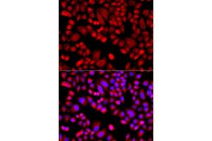 Immunofluorescence analysis of  cells using  antibody (ABIN6129197, ABIN6137129, ABIN6137130 and ABIN6223718). (ARPC3 Antikörper  (AA 1-178))