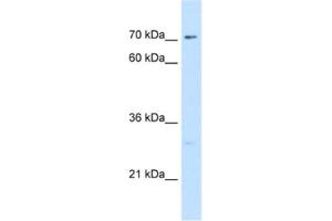 Western Blotting (WB) image for anti-CTP Synthase (CTPS) antibody (ABIN2462930) (CTP Synthase Antikörper)