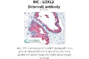 Image no. 2 for anti-Lysyl Oxidase-Like 2 (LOXL2) (Internal Region) antibody (ABIN1736515)