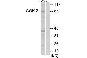 Western blot analysis of extracts from HUVEC cells, using CGK 2 antibody. (PRKG2 Antikörper  (Internal Region))