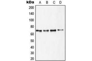 Western blot analysis of S6K1 expression in MCF7 (A), HEK293 (B), MDCK (C), mouse brain (D) whole cell lysates. (RPS6KB1 Antikörper  (C-Term))
