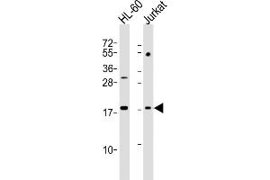 All lanes : Anti-KISS1 Antibody (N-Term) at 1:2000 dilution Lane 1: HL-60 whole cell lysates Lane 2: Jurkat whole cell lysates Lysates/proteins at 20 μg per lane. (KISS1 Antikörper  (AA 20-52))
