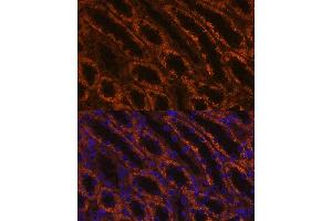 Immunofluorescence (IF) image for anti-Laminin, gamma 2 (LAMC2) (AA 862-1111) antibody (ABIN6143076)