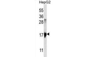 Western Blotting (WB) image for anti-Keratin Associated Protein 1-3 (KRTAP1-3) antibody (ABIN2996875) (KRTAP1-3 Antikörper)