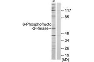 Western blot analysis of extracts from Jurkat cells, using PFKFB2 Antibody. (PFKFB2 Antikörper  (AA 1-50))