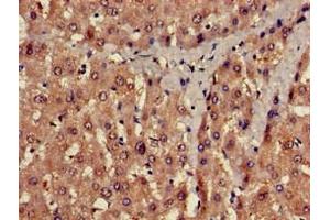 Immunohistochemistry of paraffin-embedded human liver tissue using ABIN7175541 at dilution of 1:100 (PROC Antikörper  (AA 288-409))
