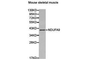 Western Blotting (WB) image for anti-NADH Dehydrogenase (Ubiquinone) 1 alpha Subcomplex, 9, 39kDa (NDUFA9) antibody (ABIN2650936)