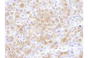 Immunohistochemistry (IHC) image for anti-NUDC (AA 281-331) antibody (ABIN7455044) (NUDC Antikörper  (AA 281-331))